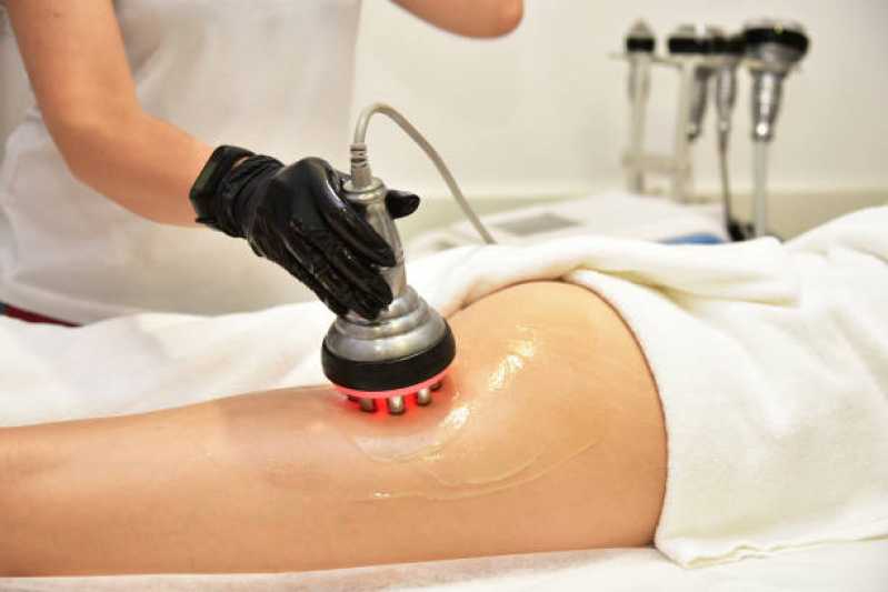 Agendar Massagem Redutora de Gordura Localizada Estância Recreativa San Fernando - Massagem Modeladora para Barriga