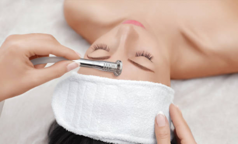 Tratamento de Peeling de Diamante para Melasma Residencial Nova Era - Peeling de Diamante Facial Campinas